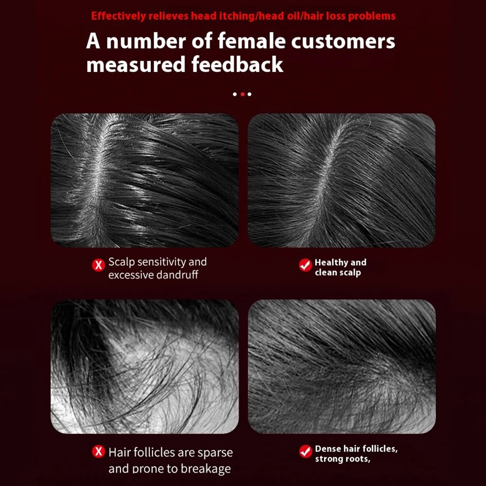 Electric Vibration Massage Comb with Red Light Therapy